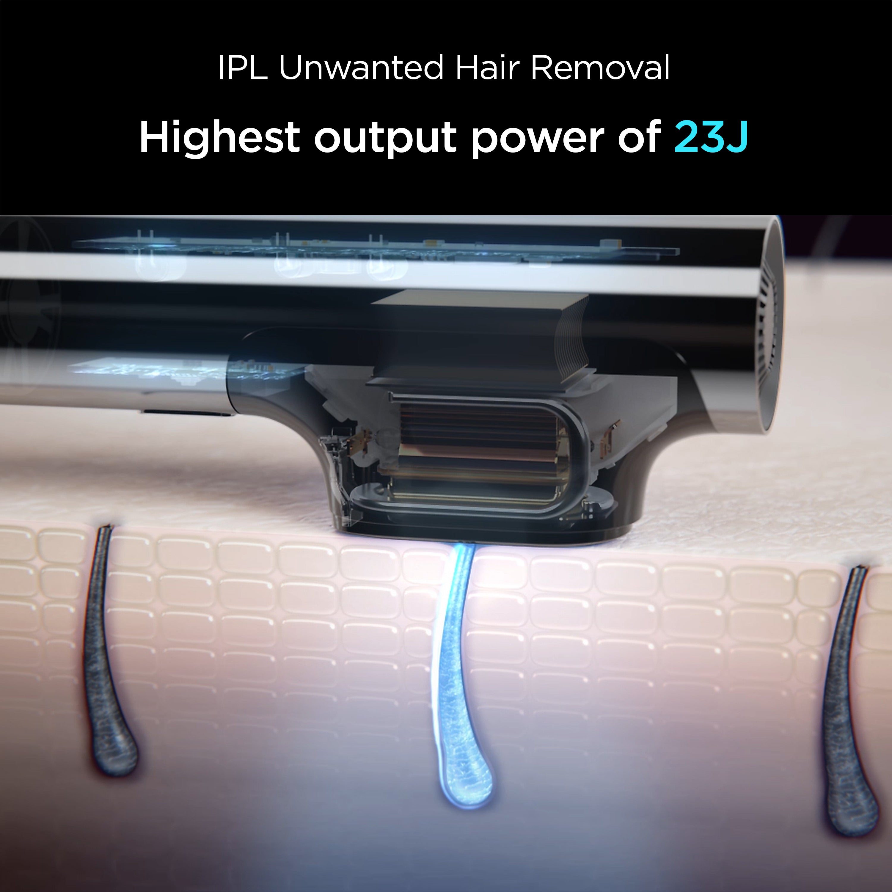 MiRAY 2-in-1 IPL Hair Removal & DPL Photofacial