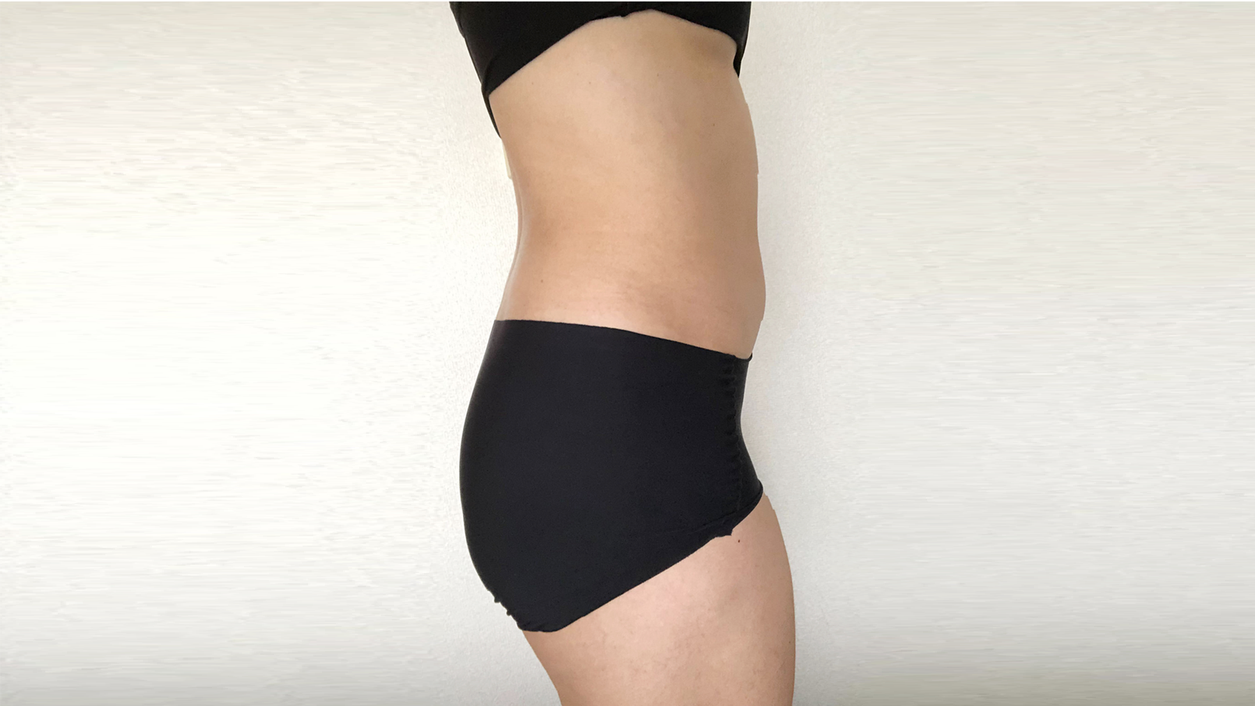 PROVE-after-skin-lift
