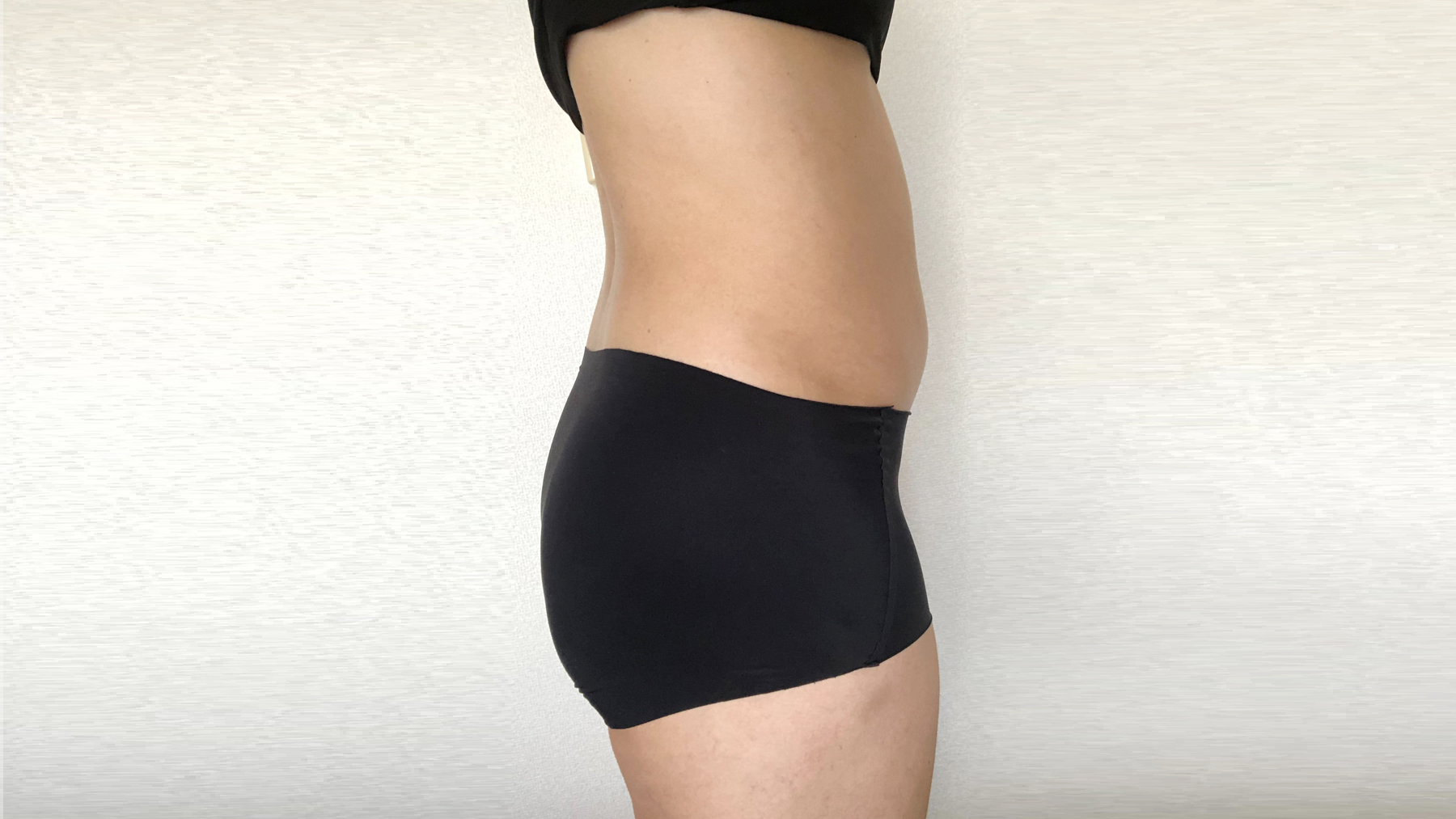 PROVE-before-skin-lift