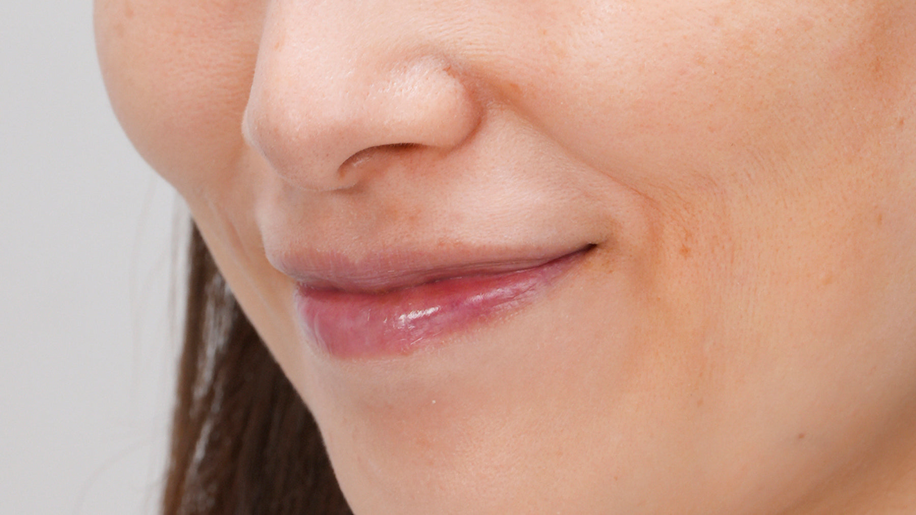 after-using-miray-one-dpl-light-therapy