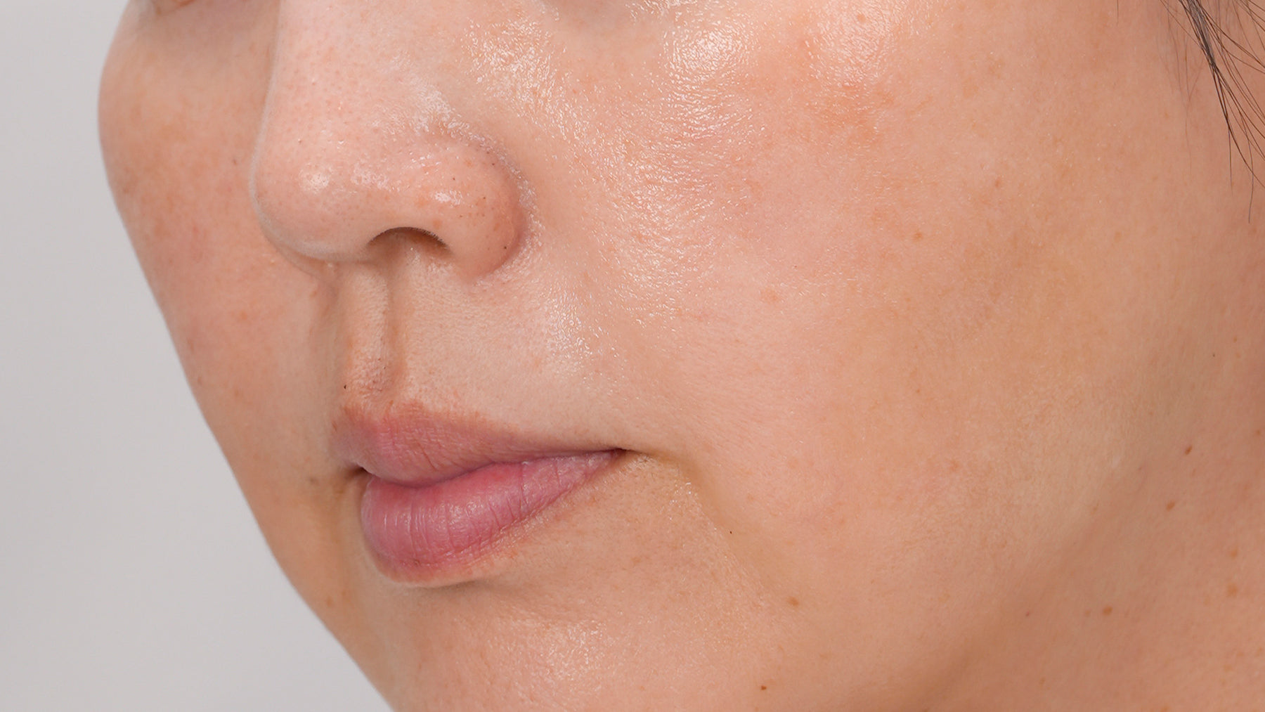 after-using-miray-one-nir-light-therapy