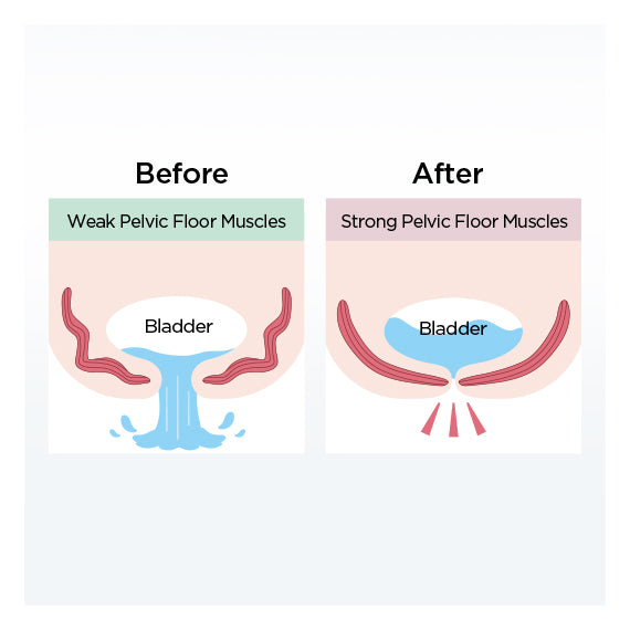 aqua-qutto-pelvic-floor-training-for-bladder-benefits