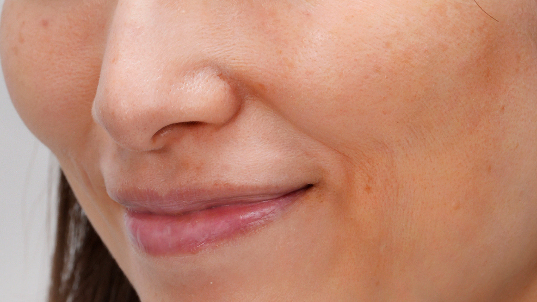 before-using-miray-one-dpl-light-therapy