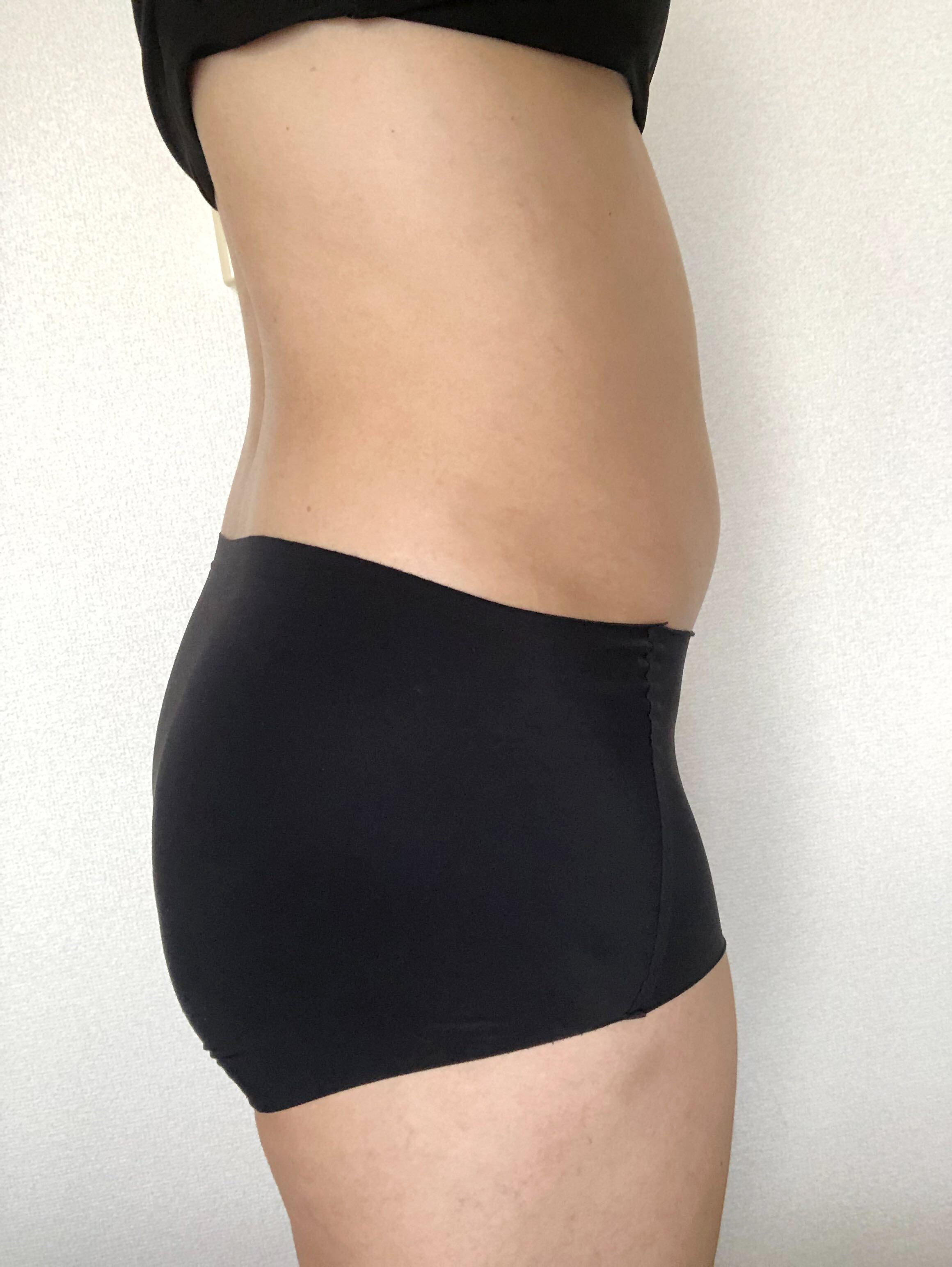 before-using-the-PROVE-body-attachment