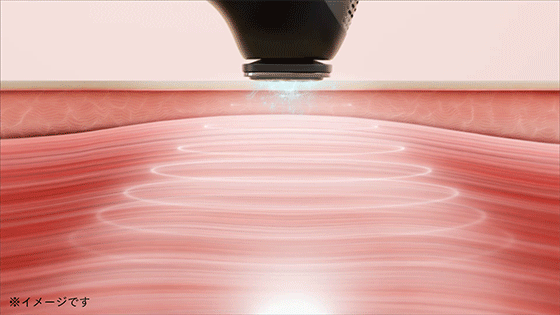 miray-one-ems-microcurrent-toning-animated-effect