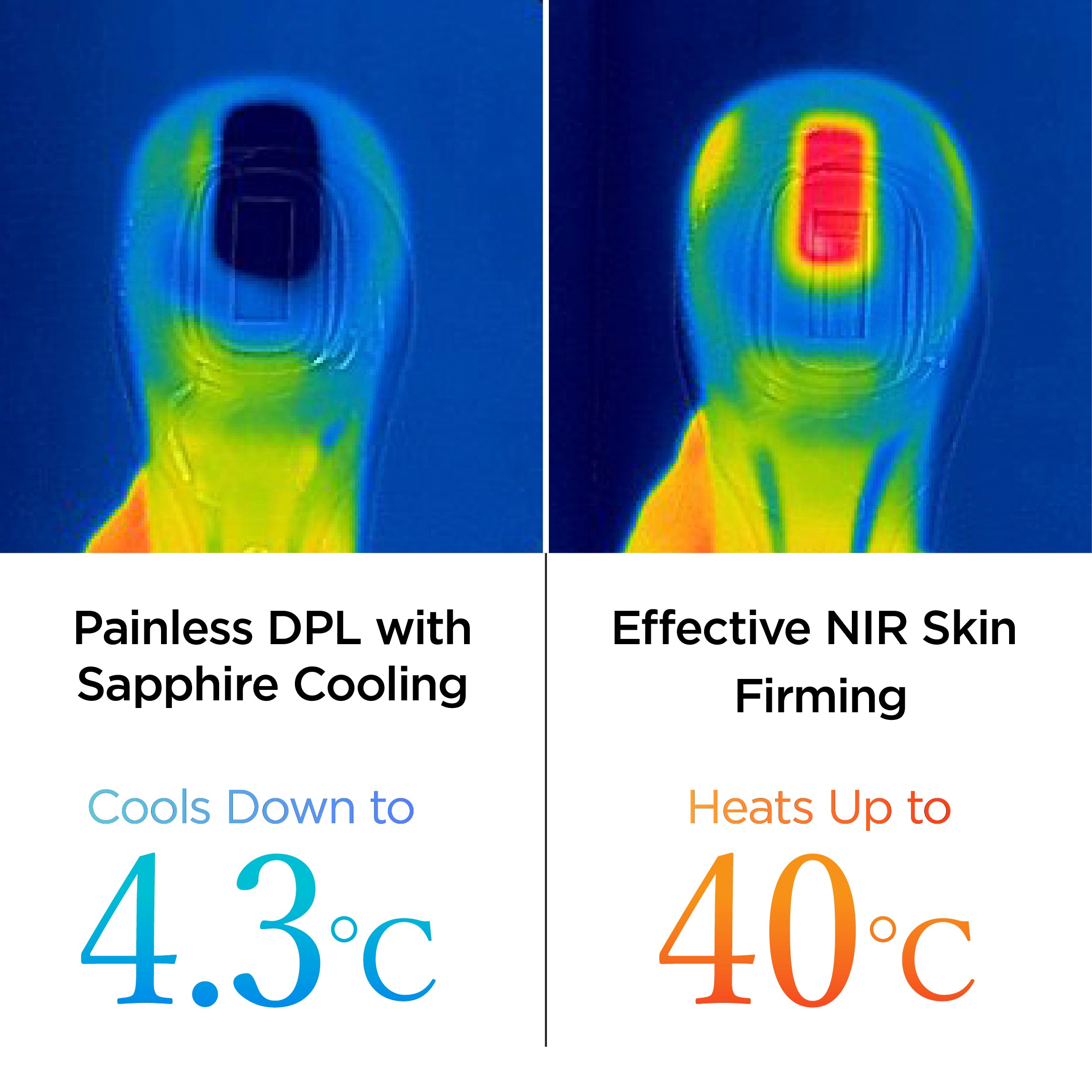 miray-one-painless-dpl-and-nir-technologies
