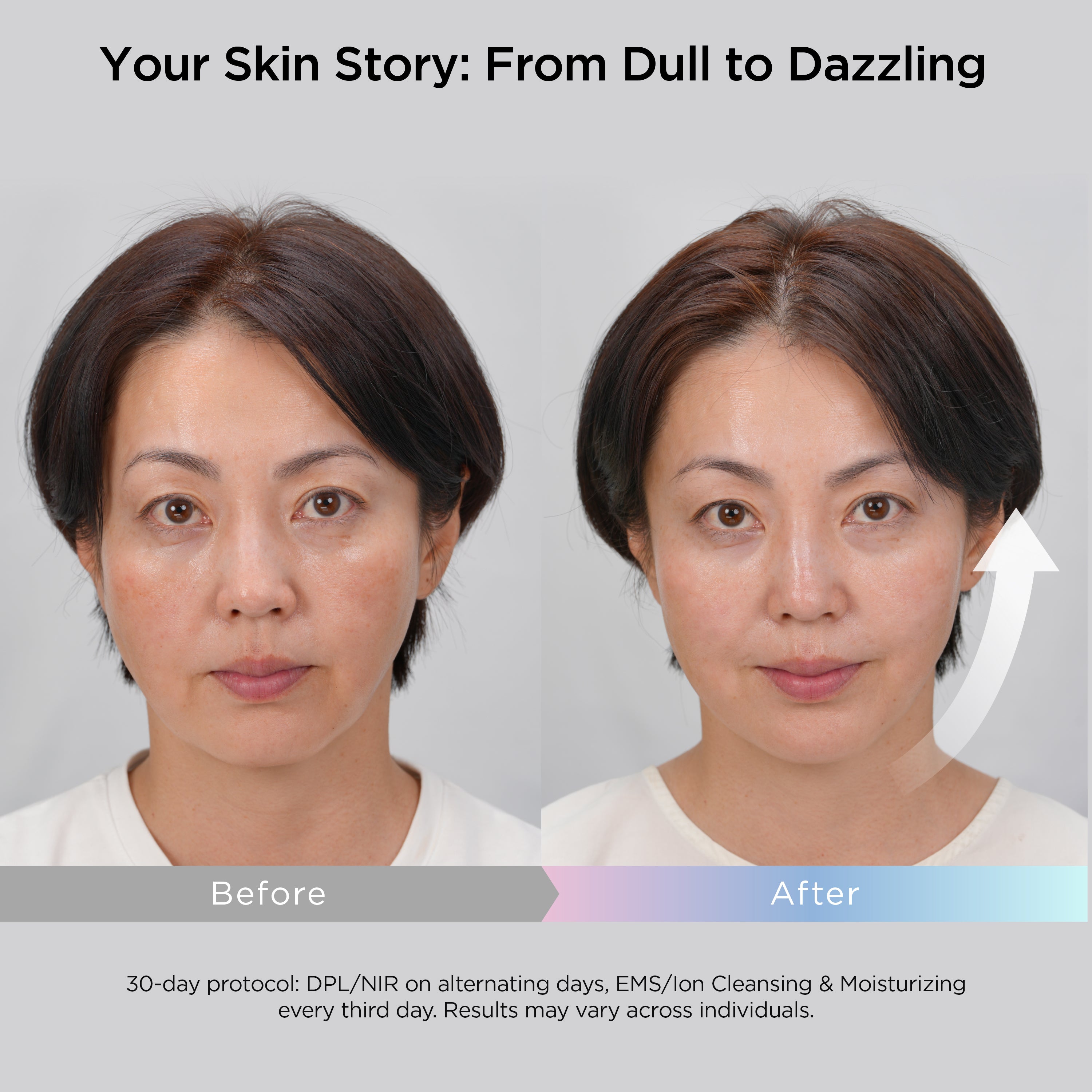 MiRAY ONE 5-in-1 Beauty Device