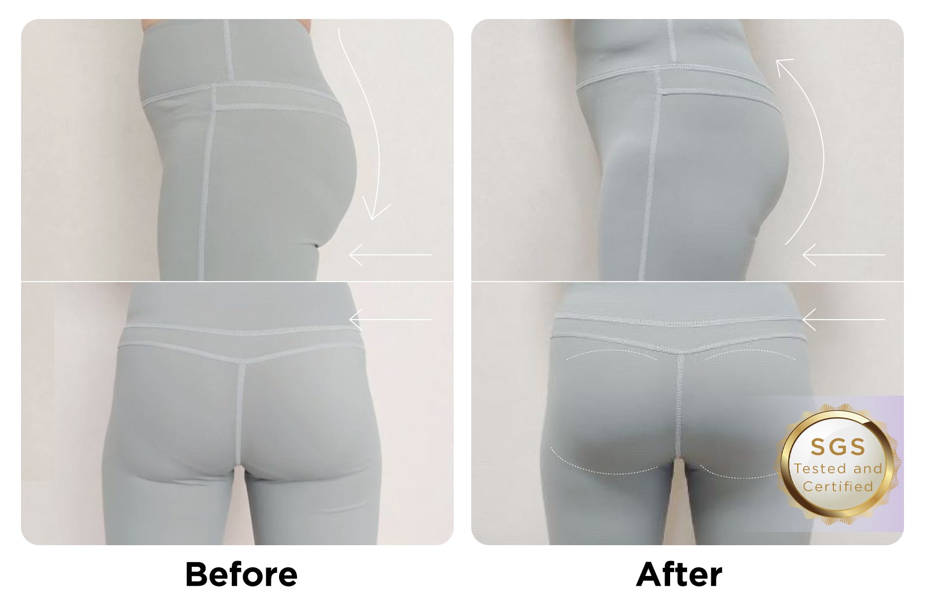 MYTREX-AQUA-LIFT-Before-After