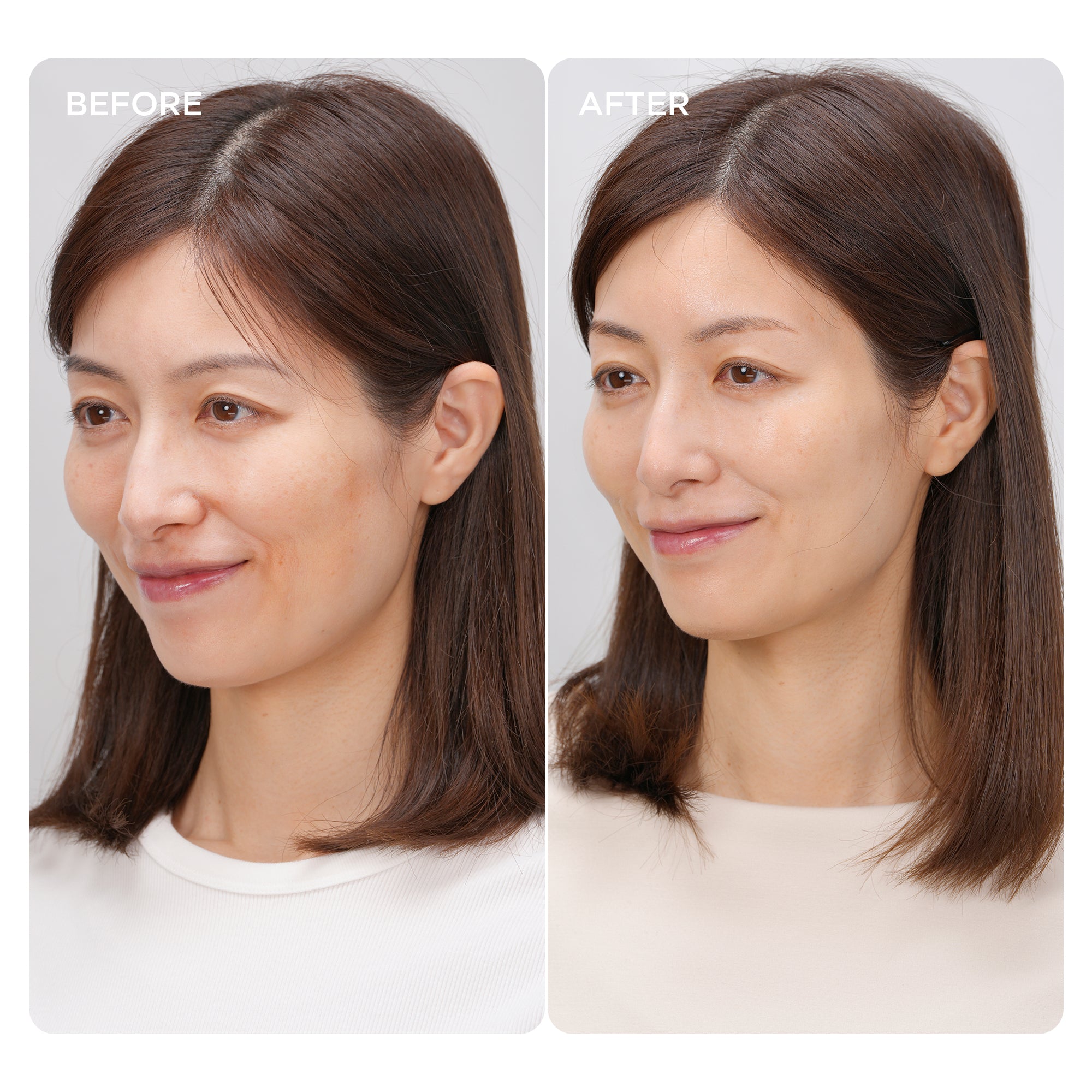 Skin before and after 30 days of DPL mode
