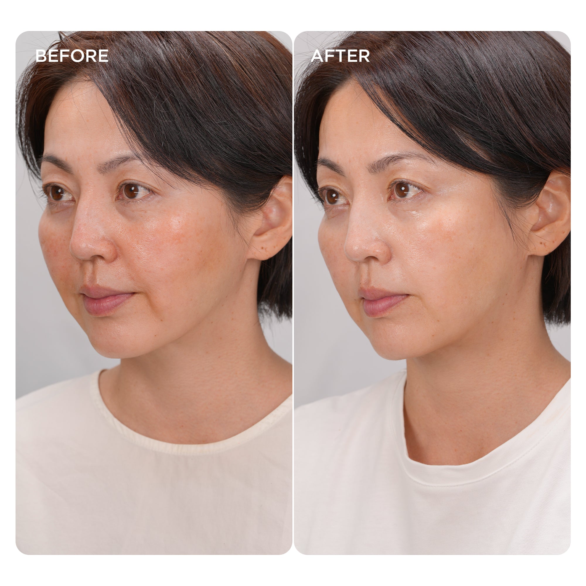 Skin before and after 30 days of NIR mode