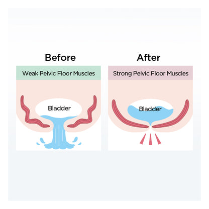 aqua-qutto-pelvic-floor-training-for-bladder-benefits