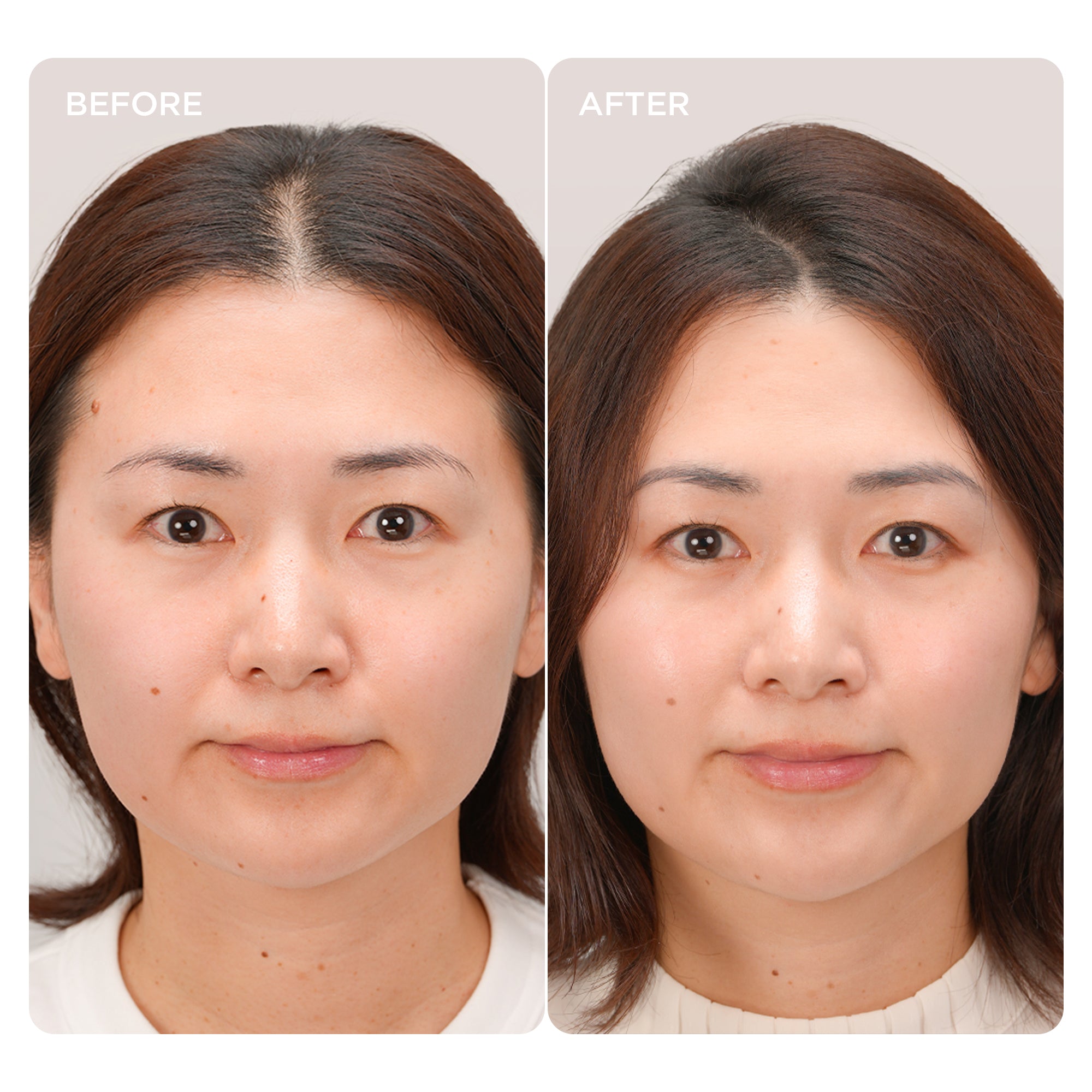 Scalp before and after 3-minute massage on high-speed mode