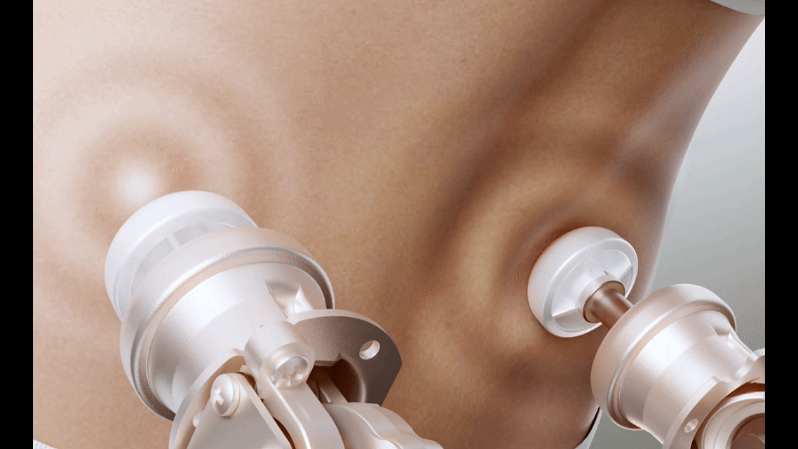 medicag-lc-egg-tapping