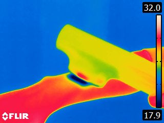 miray-patented-cooling-system-for-painless-hair-removal