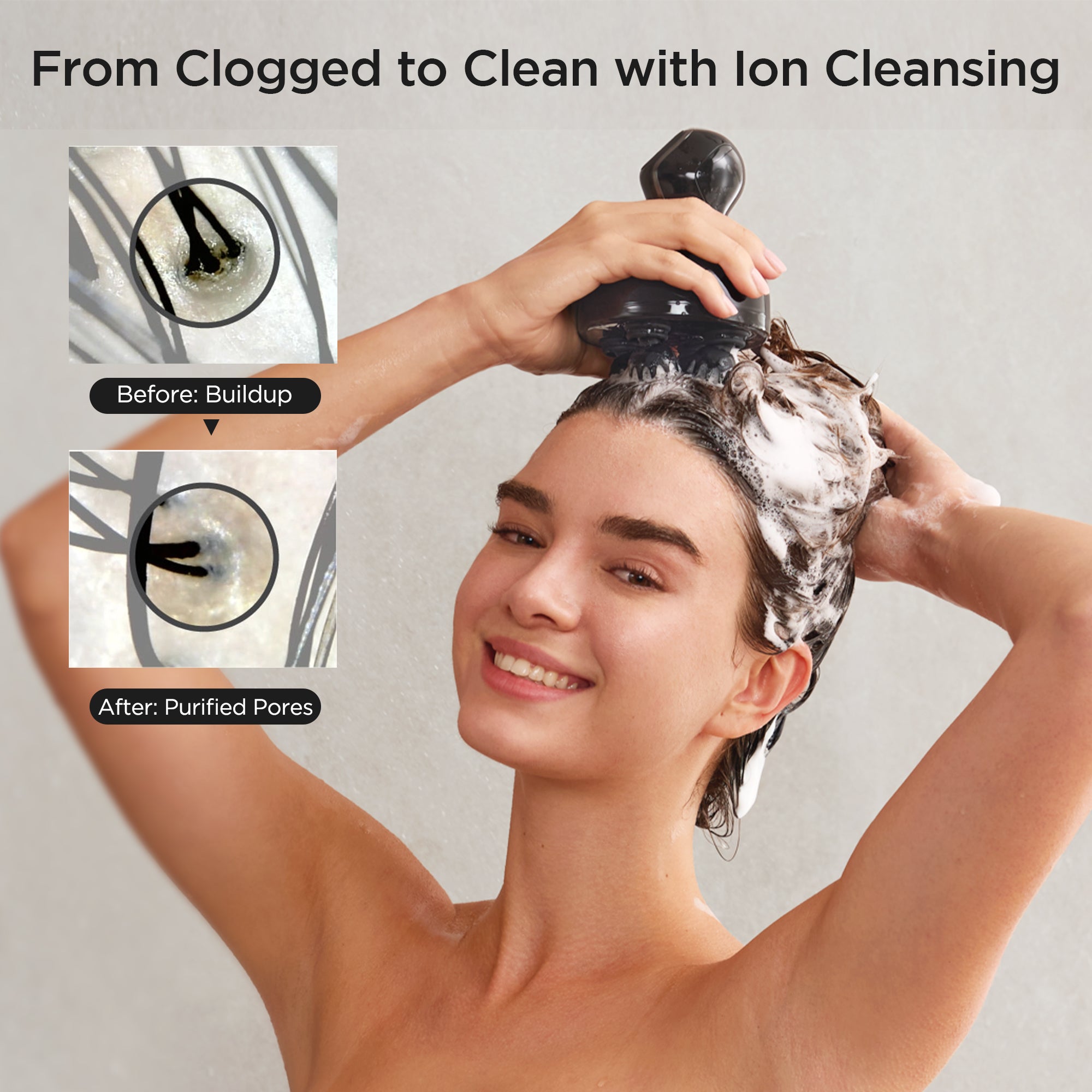 Head Spa Deep X Scalp Massager – MYTREX Global