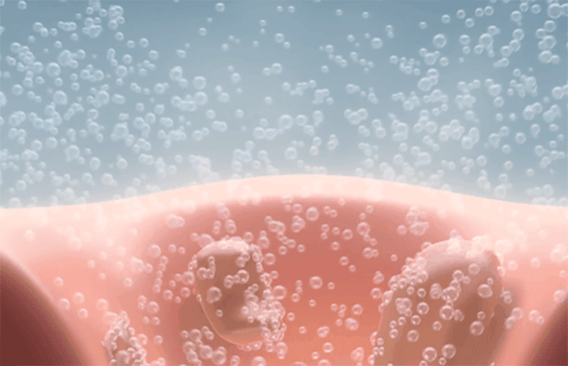 mytrex-nanobubble-showerhead-pores-cleansing-bubbles