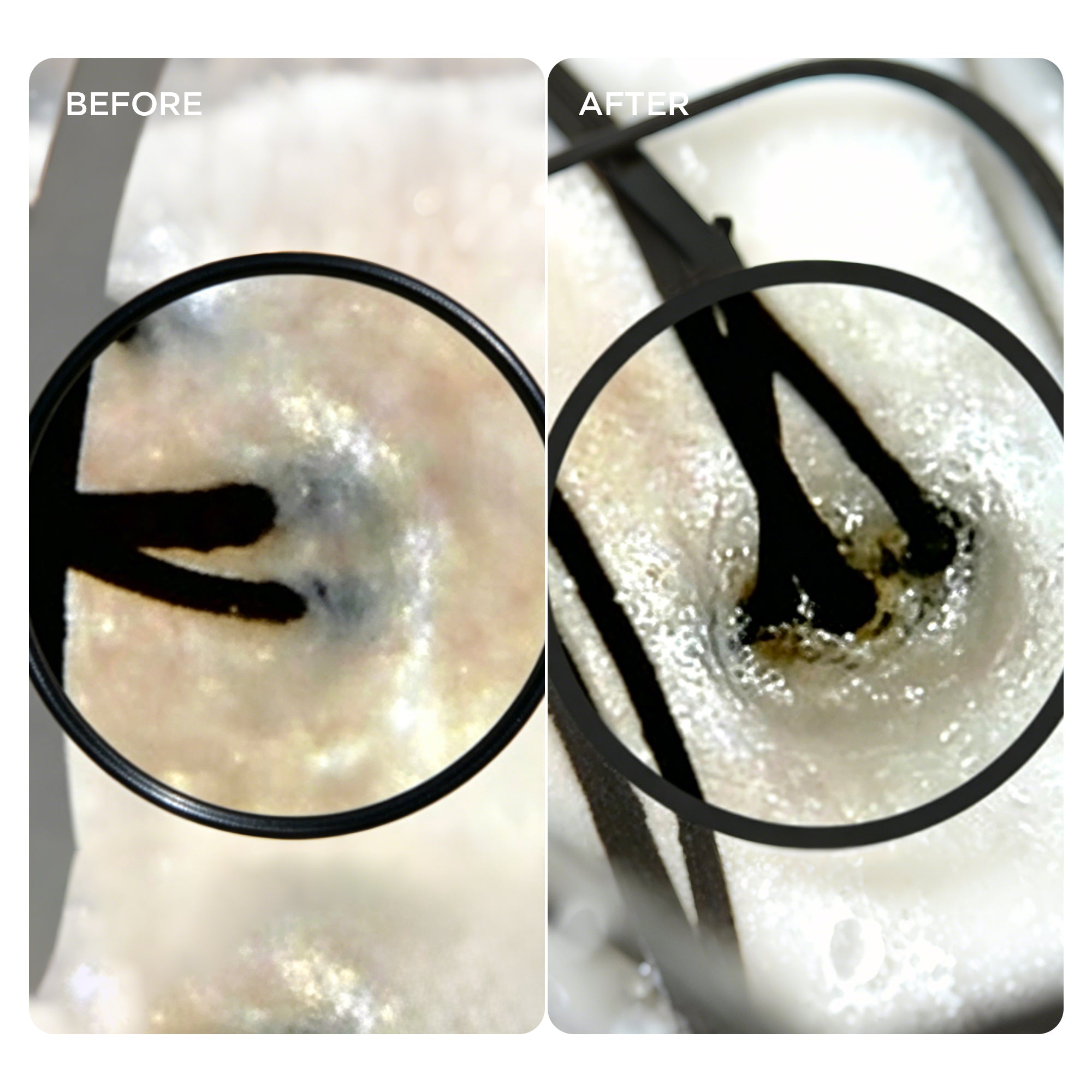 Scalp pores before and after 3-minute massage during hair wash